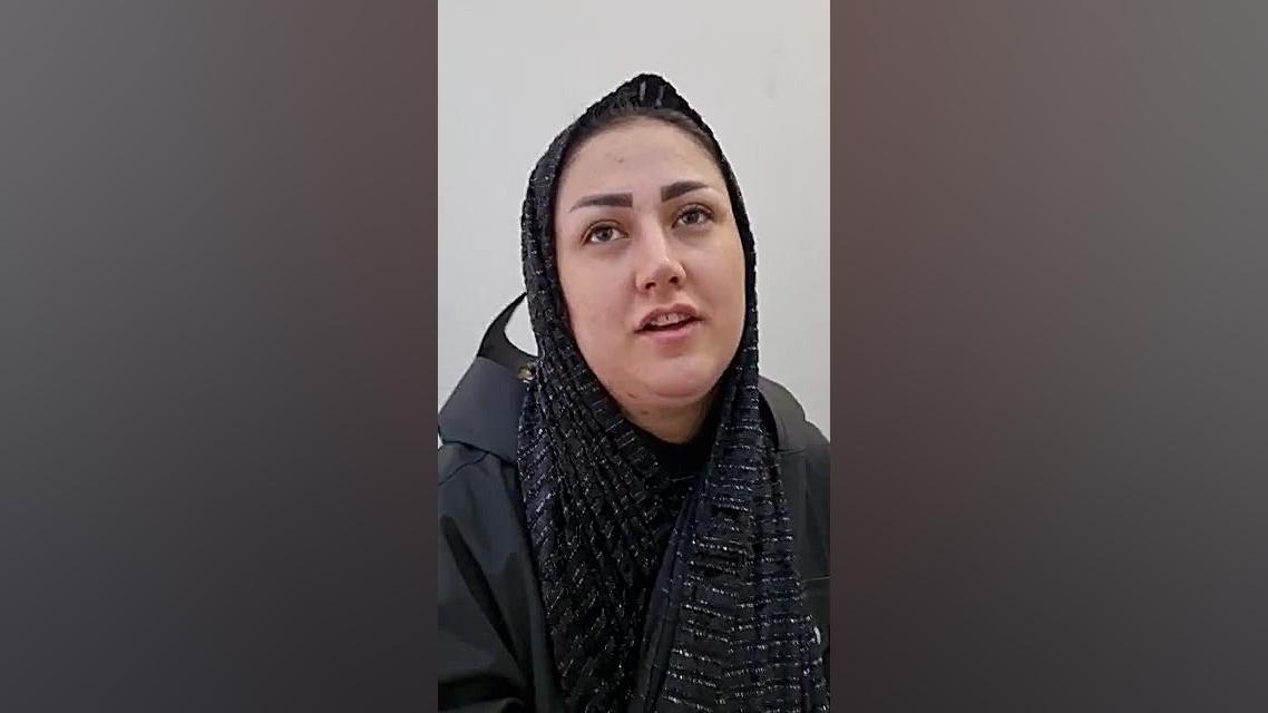 جراحی زیبایی بینی دکتر مهرداد مقیمی بینی استخوانی به سبک طبیعی دکتر مهرداد مقیمی