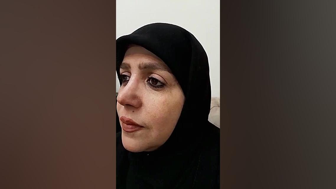 جراحی زیبایی بینی دکتر مهرداد مقیمی - بینی نیمه فانتزی دکتر مهرداد مقیمی