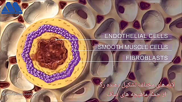 شیراز گشت در رابطه با پرفشاری شریان ریوی می گوید . سیتوژنتیک مولکولی