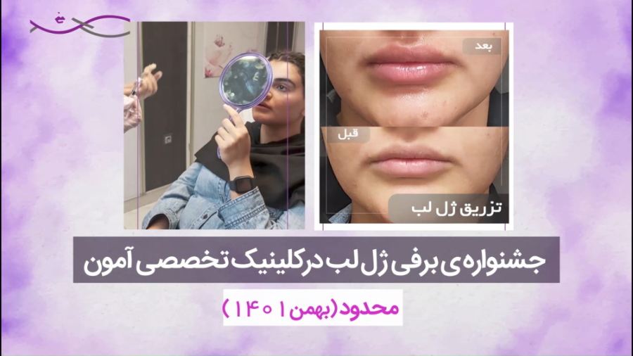 تخفیف یک میلیون تومانی تزریق ژل Autophagy Detection Kit