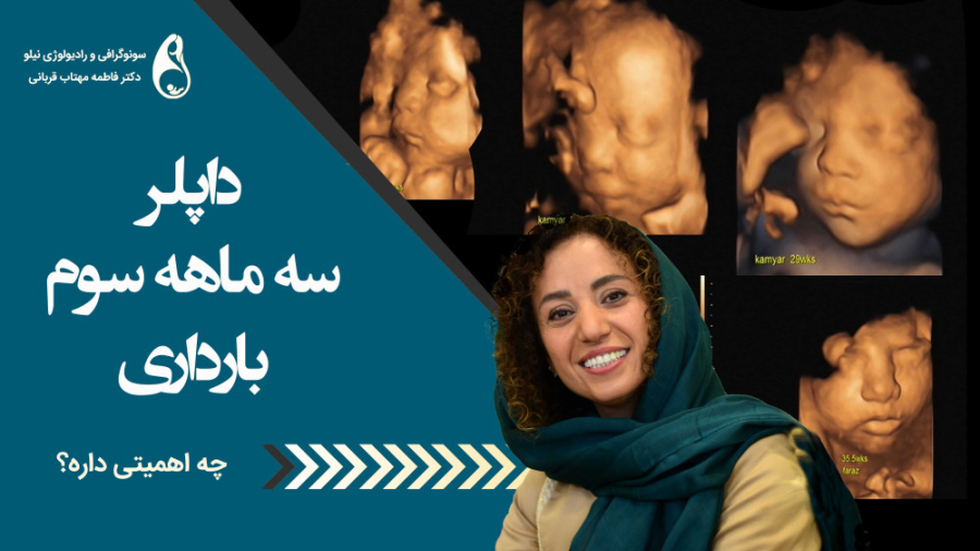 سونوگرافی داپلر - کالرداپلر سونوگرافی نیلو دکتر فاطمه مهتاب قربانی