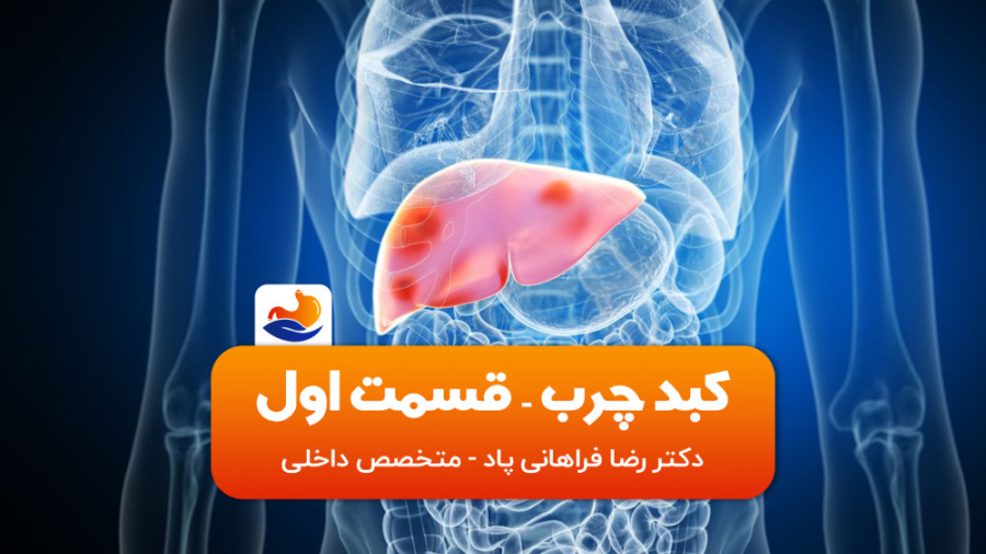 کبد چرب تشخیص و علائم - دکتر رضا فراهانی پاد دکتر رضا فراهانی پاد