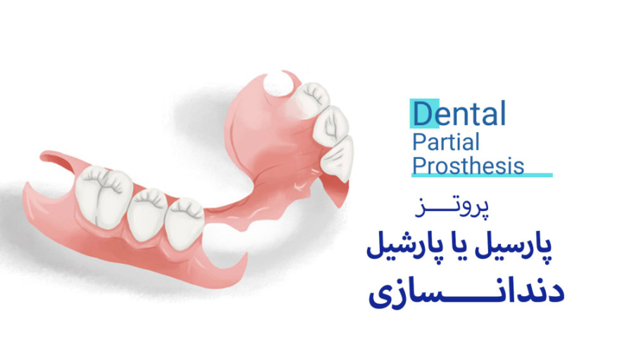 پروتز پارسیل چیست و چگونه انجام می شود؟ رفع افتادگی پلک