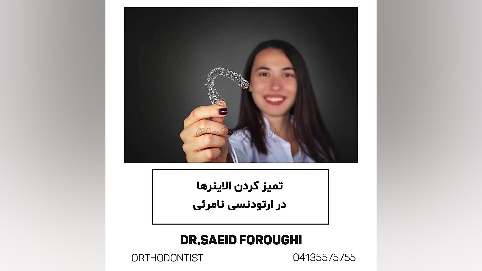 تمیز کردن الاینرها دکتر سعید فروغی متخصص ارتودنسی