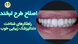 اصلاح طرح لبخند / راههای شناخت دندانپزشک زیبایی خوب اصلاح طرح لبخند / راههای شناخت دندانپزشک زیبایی خوب