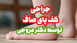 عمل جراحی کف پای صاف عمل جراحی کف پای صاف