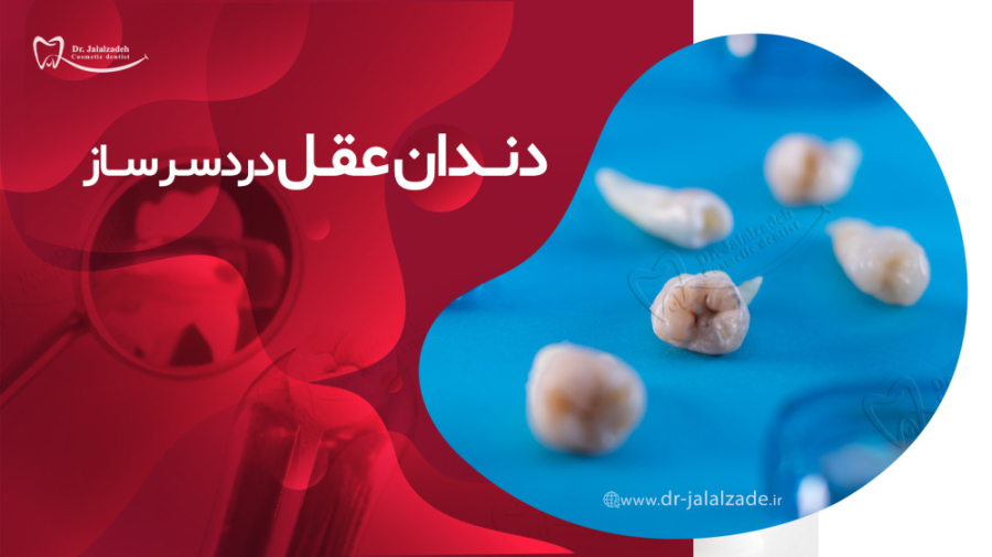در مورد دندان عقل بیشتر بدانید دکتر مرضیه جلال زاده