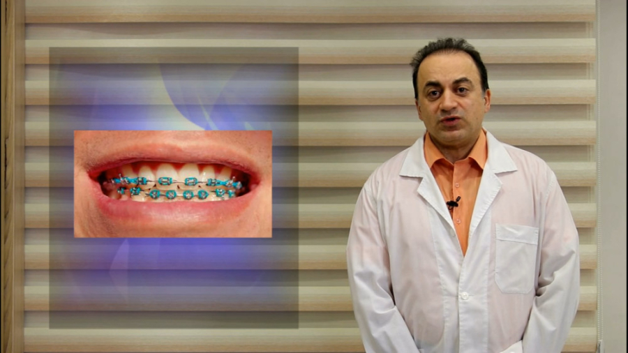 درمان بیماران شکاف لب و کام / متخصص ارتودنسی / دکتر جمیلیان دکتر عبدالرضا جمیلیان - متخصص ارتودنسی