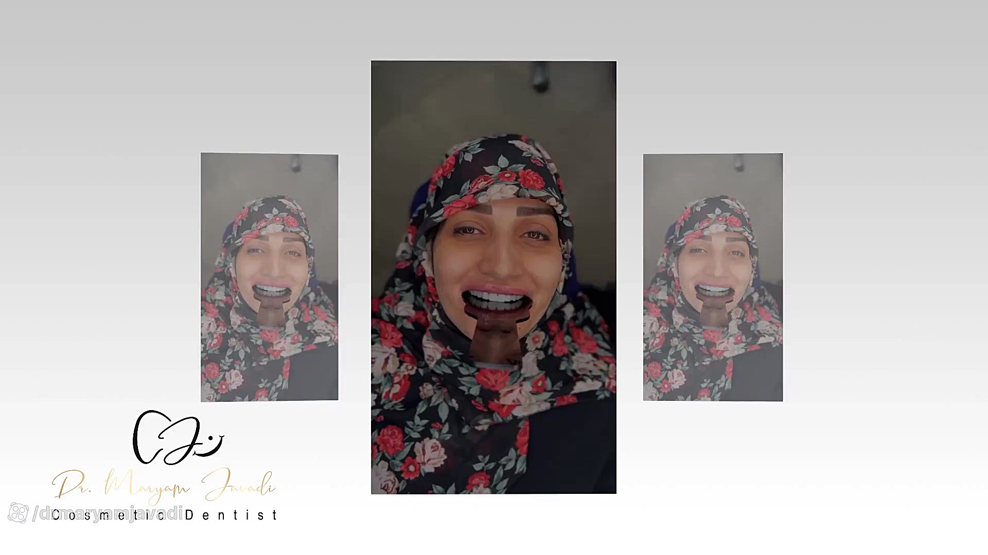 اصلاح طرح لبخند CUT&Tag