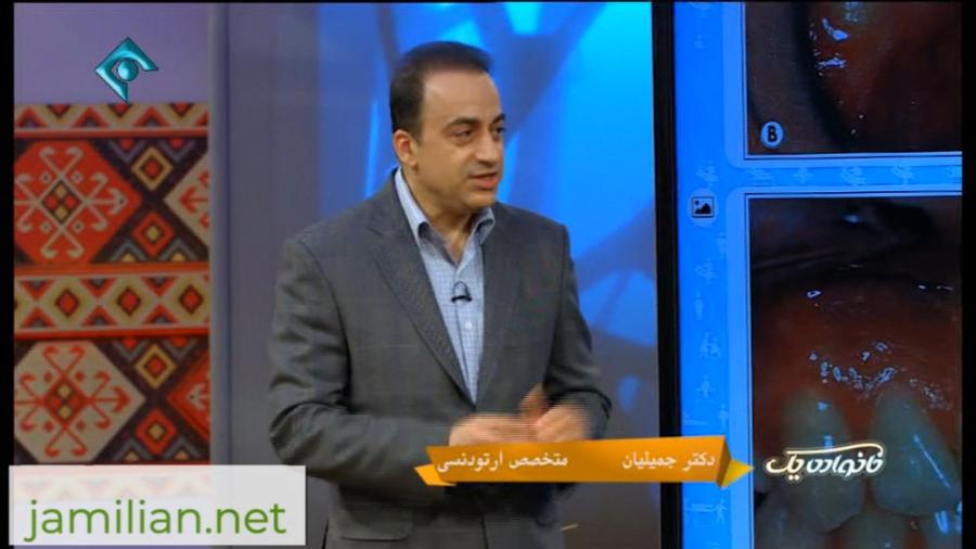 عقب بودن فک پایین چه مشکلاتی ایجاد می کند؟ / متخصص ارتودنسی / دکتر جمیلیان دکتر عبدالرضا جمیلیان - متخصص ارتودنسی