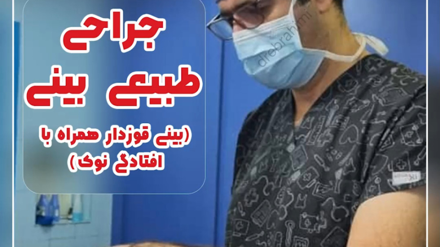 جراحی قوز و افتادگی بینی توسط دکتر امید ابراهیمی بهترین جراح بینی در تهران دکتر امید ابراهیمی