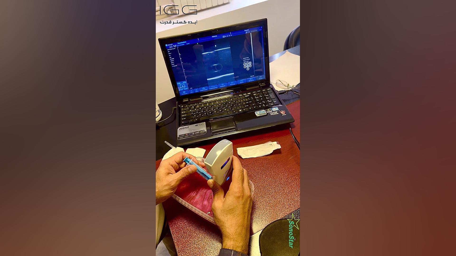 آموزش سونوگرافی با دستگاه هندهلد جراحی لثه