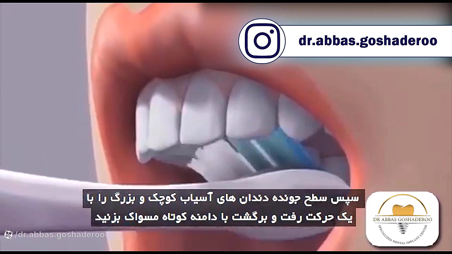 آموزش روش صحیح مسواک زدن برای بهداشت مناسب دهان و دندان دکتر عباس گشاده رو، متخصص جراحی لثه و ایمپلنت
