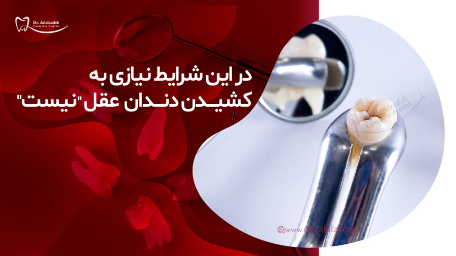 دندان عقل را در چه شرایطی می توان نکشید؟ دکتر مرضیه جلال زاده