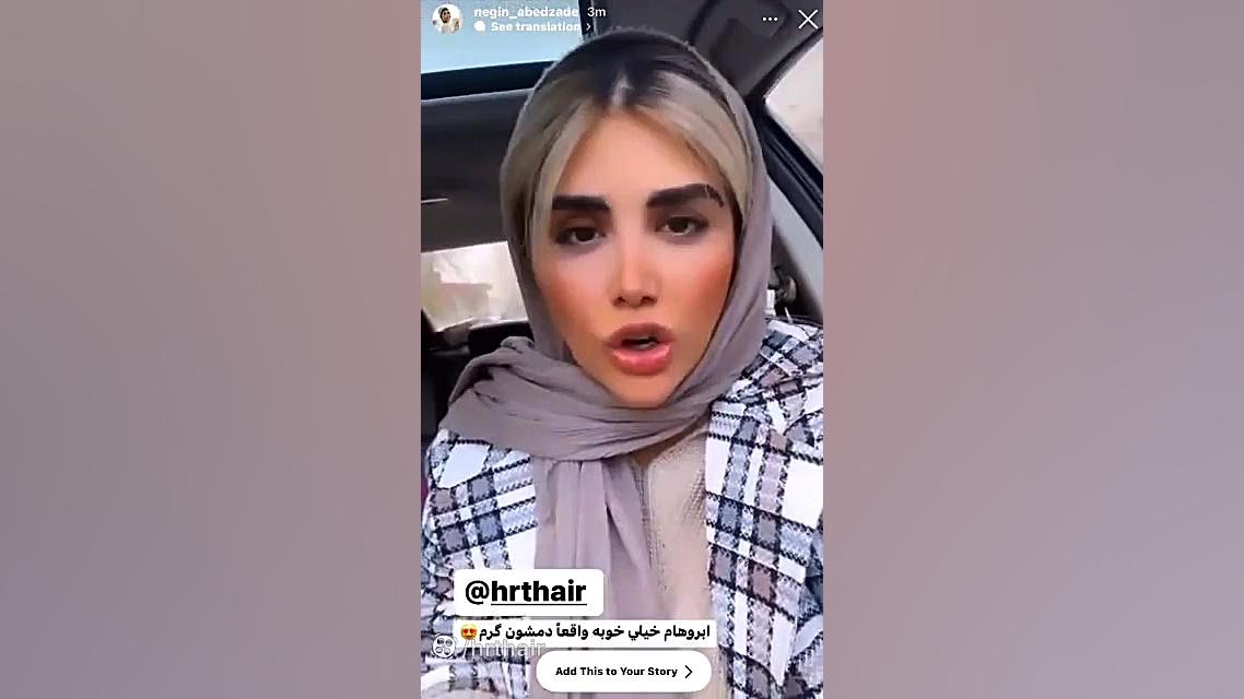 کاشت ابرو نگین عابدزاده ماکروسفالی