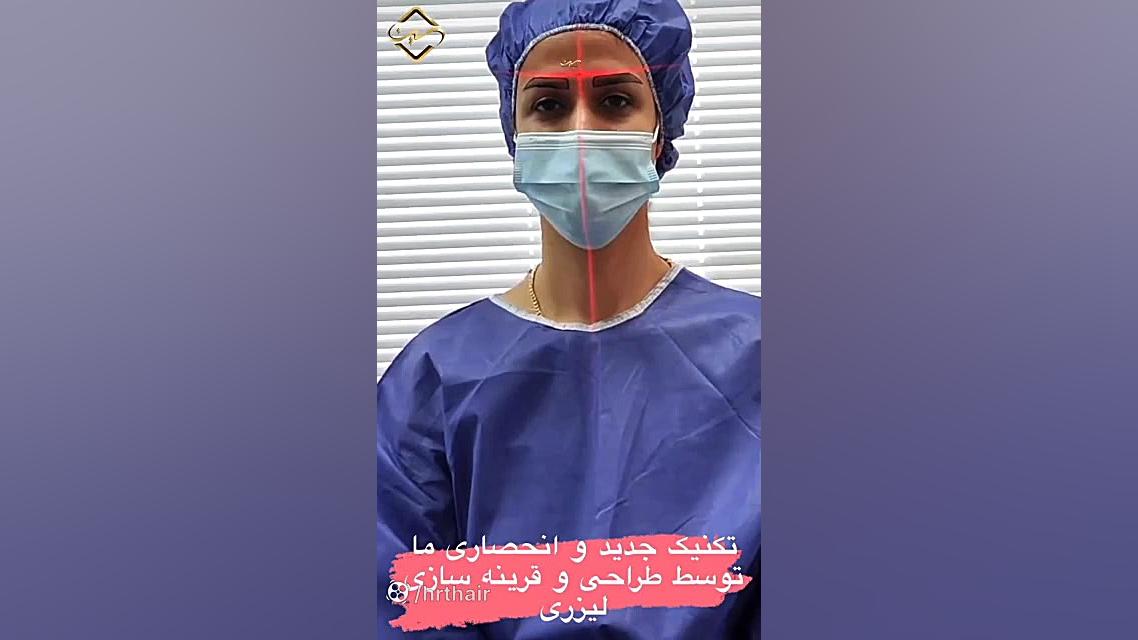 کاشت ابرو طبیعی بروموکریپتین