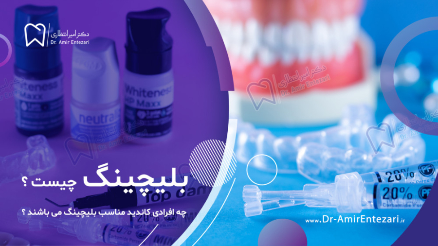 بلیچینگ چیست ؟ چه افرادی کاندید مناسب بلیچینگ می باشند ؟ دکتر امیر انتظاری