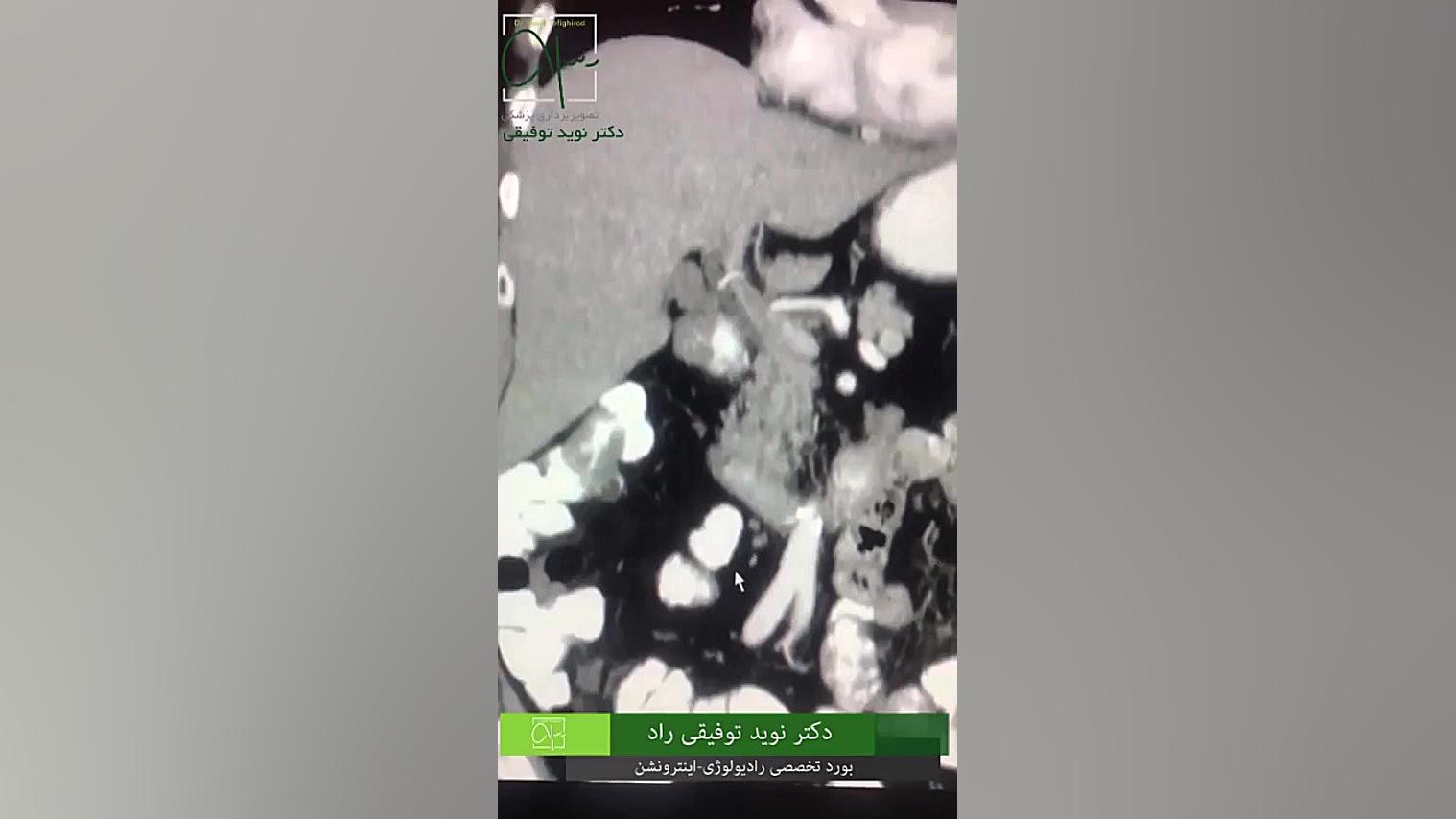 کولونوسکوپی سی تی در ولنجک رادیوگرافی دندان