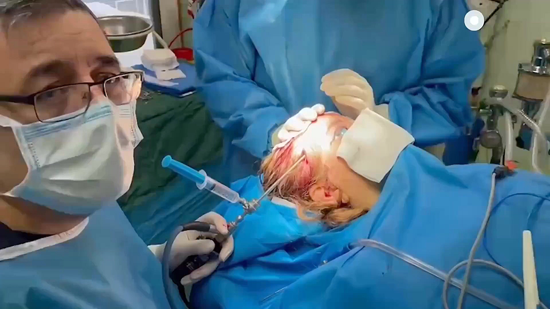جراحی آندوسکوپ لیفت پیشانی دکتر حمید رضا فتحی فوق تخصص جراحی پلاستیک