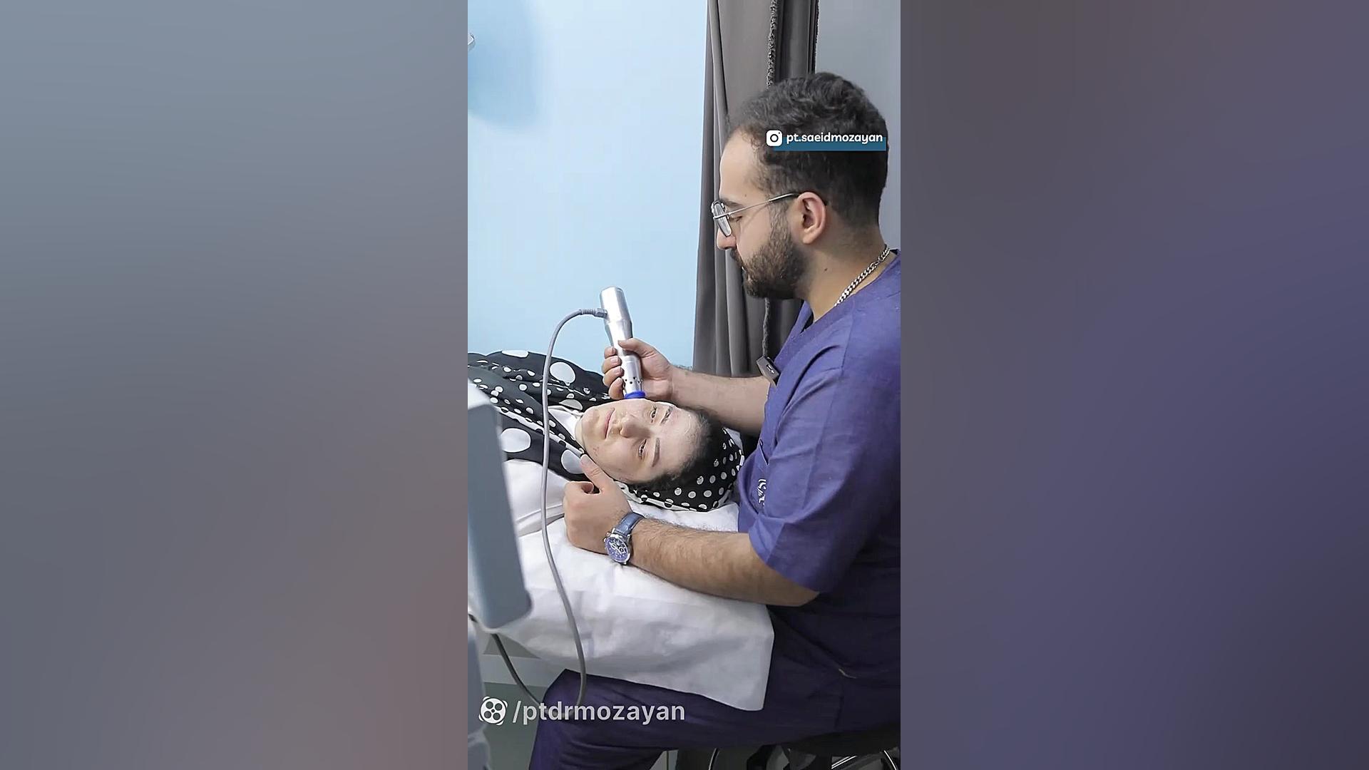 درمان فلج بلز با طب سوزنی عصب‌کشی