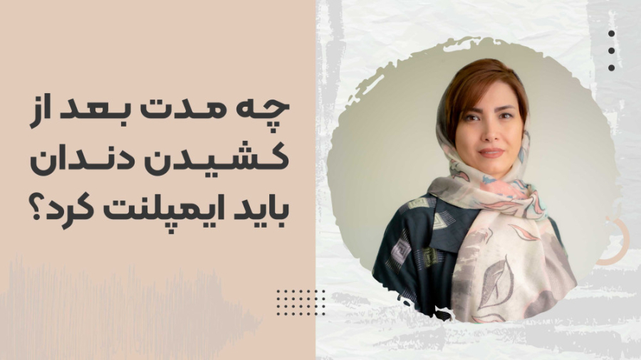 چه مدت بعد از کشیدن دندان باید ایمپلنت کرد؟ پاکسازی پوست