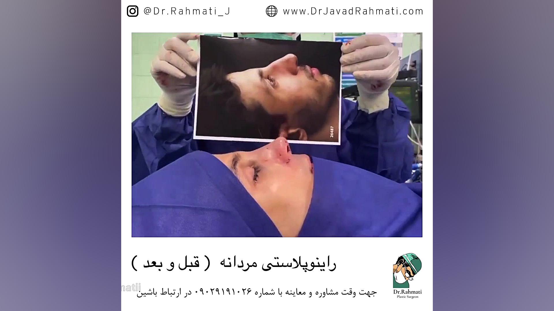 قبل و بعد جراحی بینی دکتر جواد رحمتی