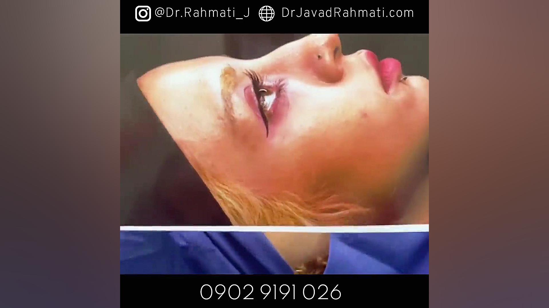 جراحی بینی نیمه فانتزی دکتر جواد رحمتی
