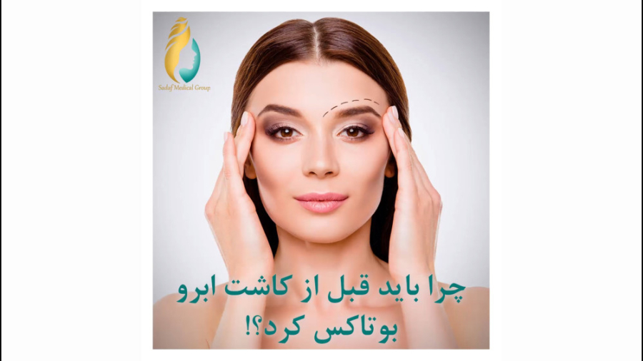 افتادگی ابرو و تزریق بوتاکس پیلینگ