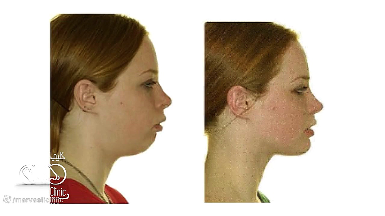جراحی فک پزشکی تله‌مدیسین تخصصی