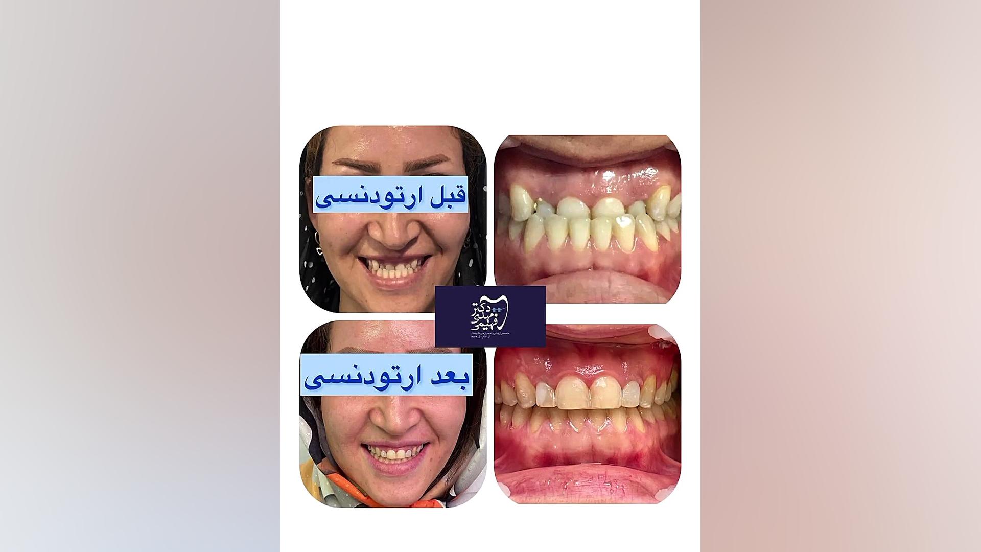 ارتودنسی دکتر فهیمی دكتر مهدي فهيمي هنزائي