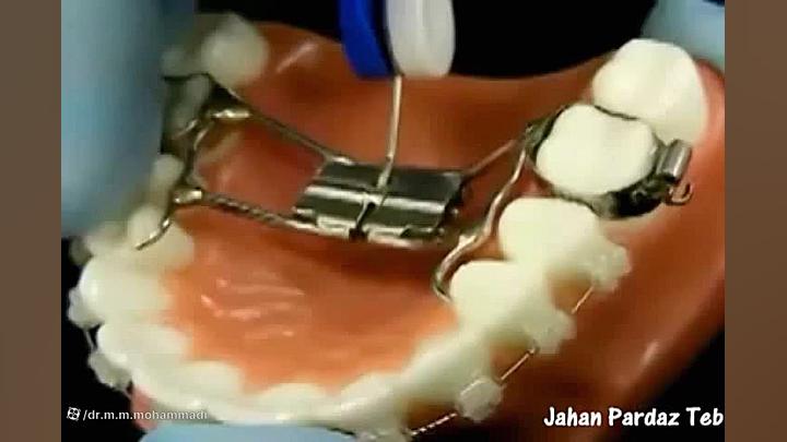 ارتودنسی 2 ارتودنسی دکتر مهیار ماهوش محمدی | متخصص ارتودنسی