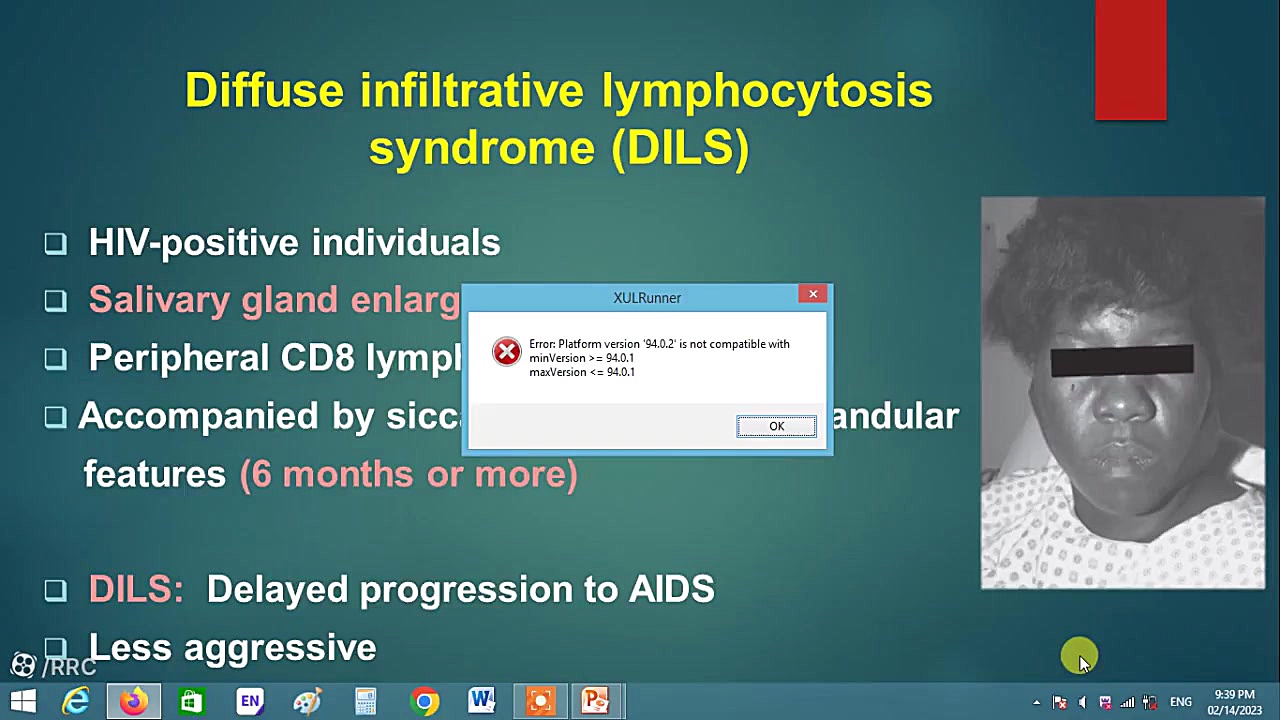 Rheumatic Manifestations of HIV دندانپزشک زیبایی
