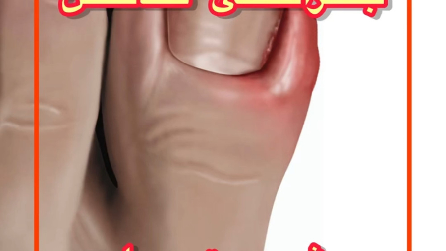 جراحی ناخن شست پا