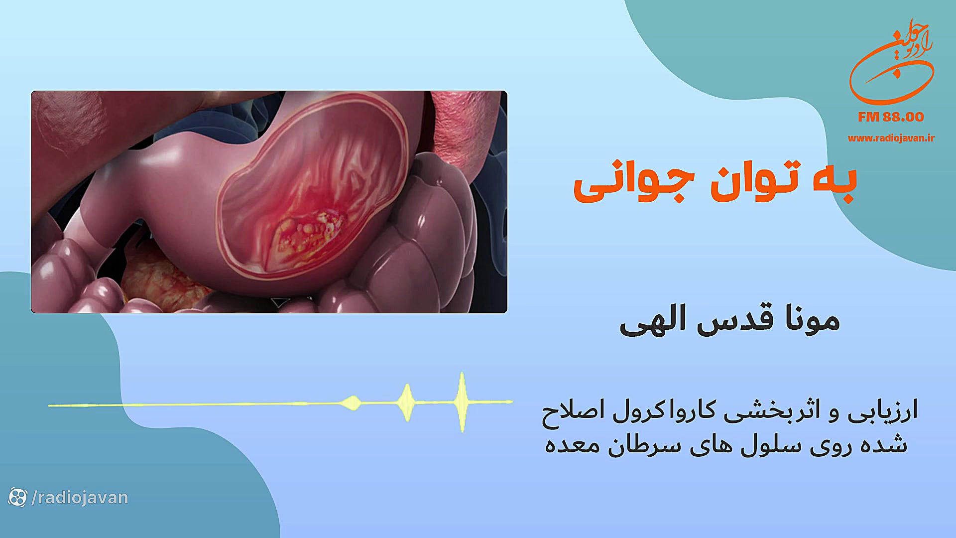 مونا قدس الهی - ارزیابی و اثربخشی کارواکرول اصلاح شده روی سلول های سرطان معده جراحی فک