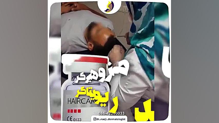 فیلم واقعی از تزریق مزوتراپی برای جلوگیری از ریزش و تقویت مو دکتر صدیقه نائیجی | متخصص پوست و مو در قم