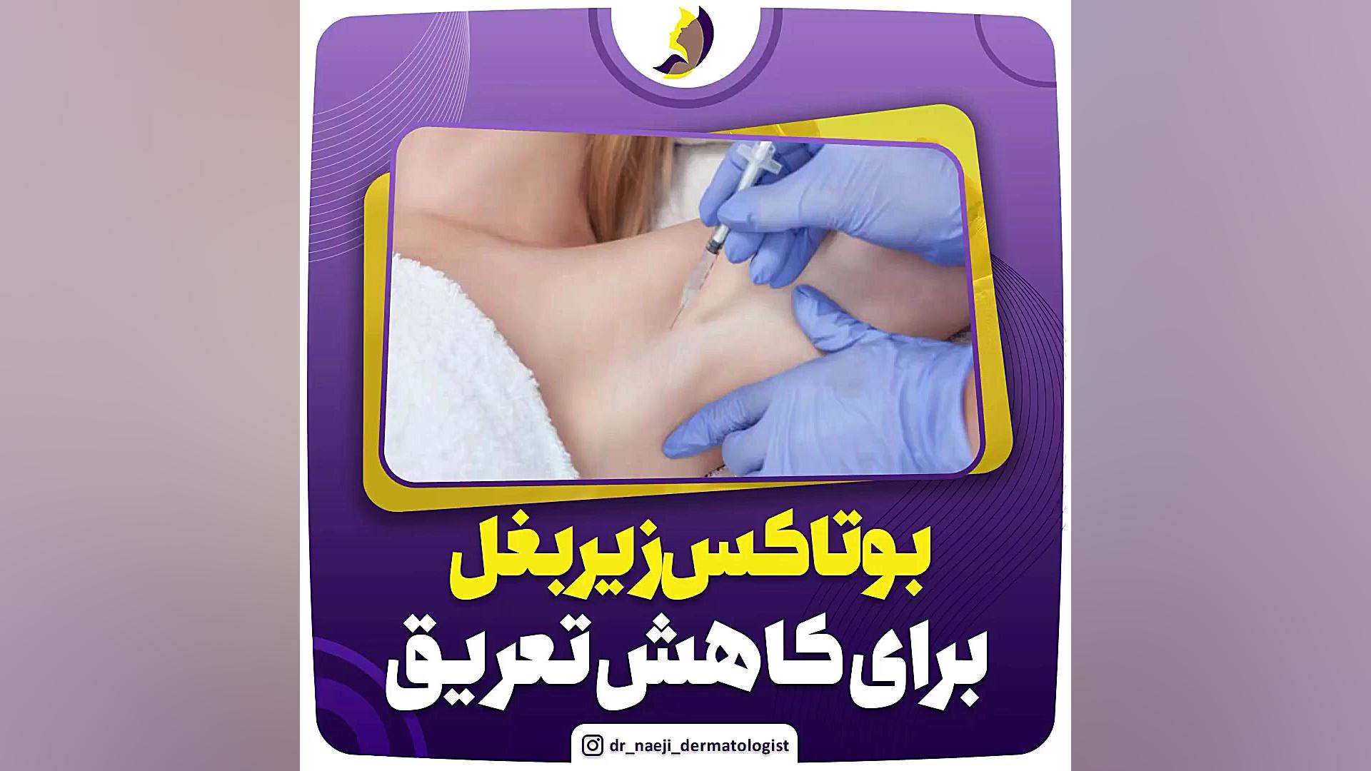 فیلم جدید و واقعی از تزریق بوتاکس زیر بغل برای کاهش تعریق لیفت گردنایمپلنت دندان