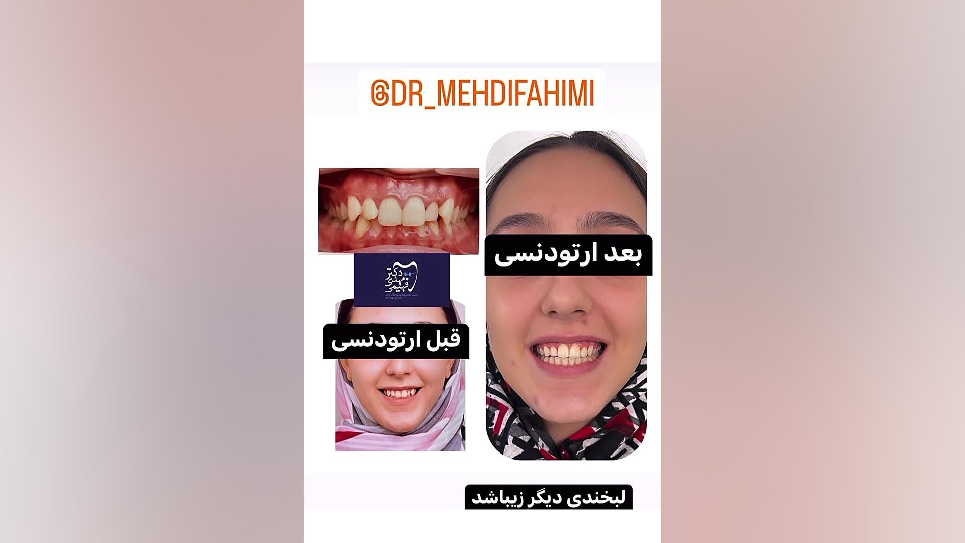 ارتودنسی دکتر فهیمی دكتر مهدي فهيمي هنزائي
