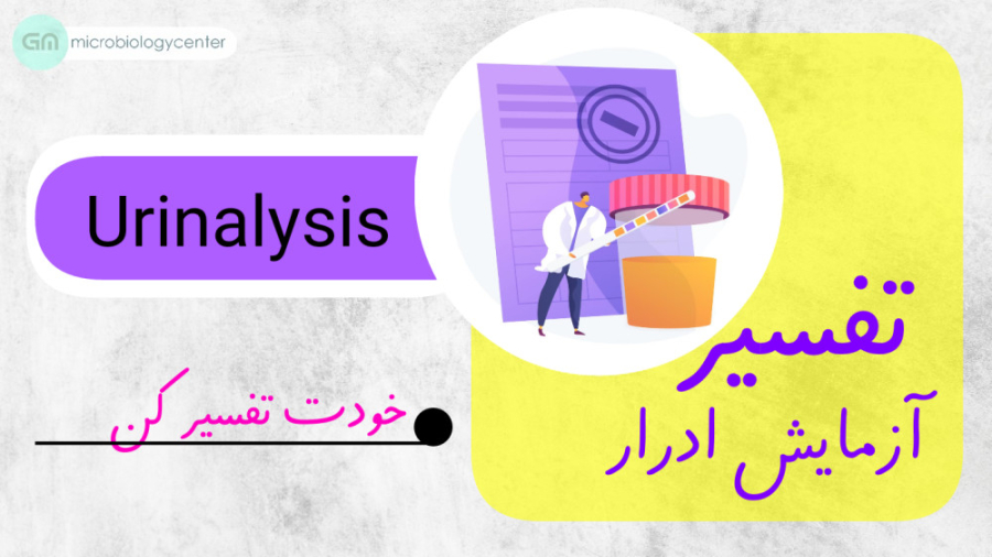 تفسیر آزمایش Urinalysis ( آزمایش ادرار) تزریق بوتاکس