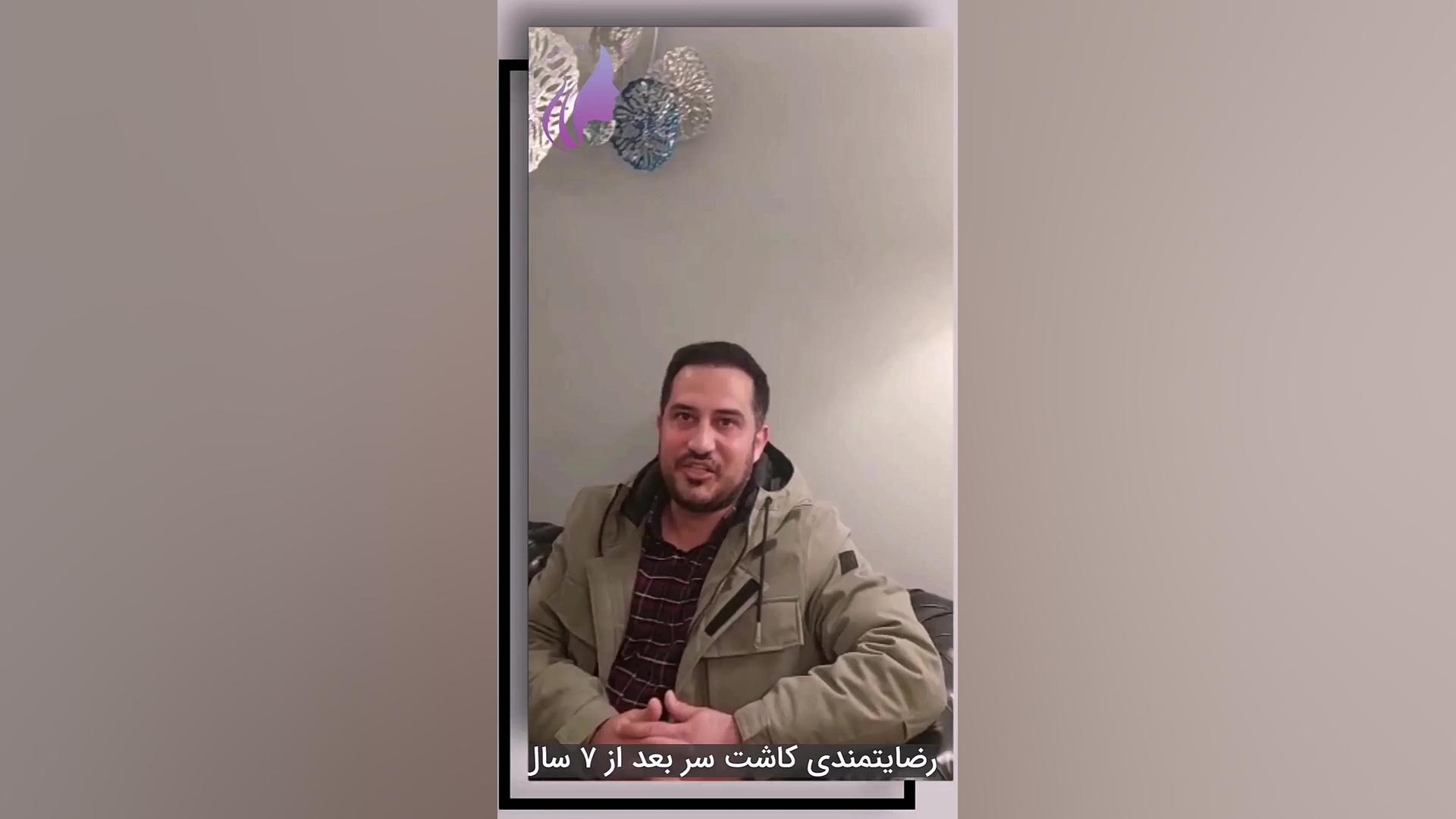 رضایتمندی از کاشت مو بعد از 7 سال دکتر صفیه چعباوی زاده