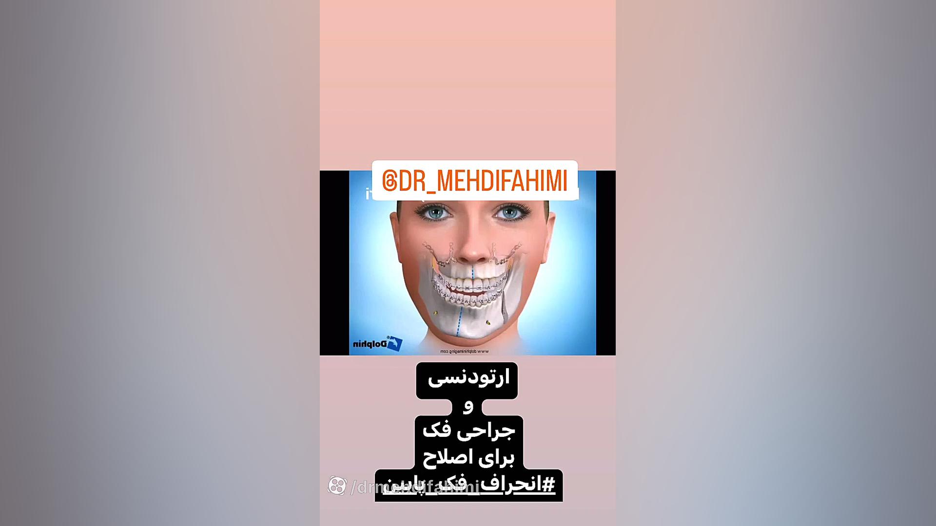 ارتودنسی و جراحی فک دكتر مهدي فهيمي هنزائي