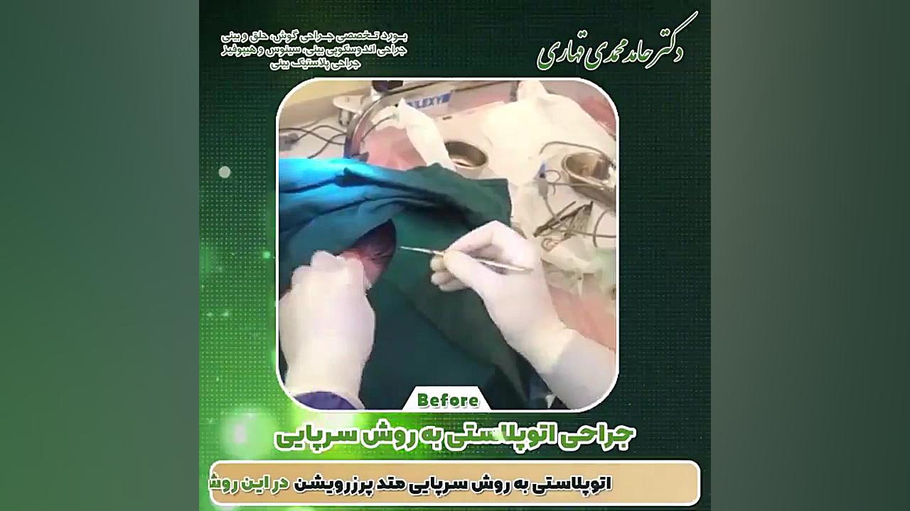 فیلم عمل گوش زیبایی دکتر حامد محمدی قهاری