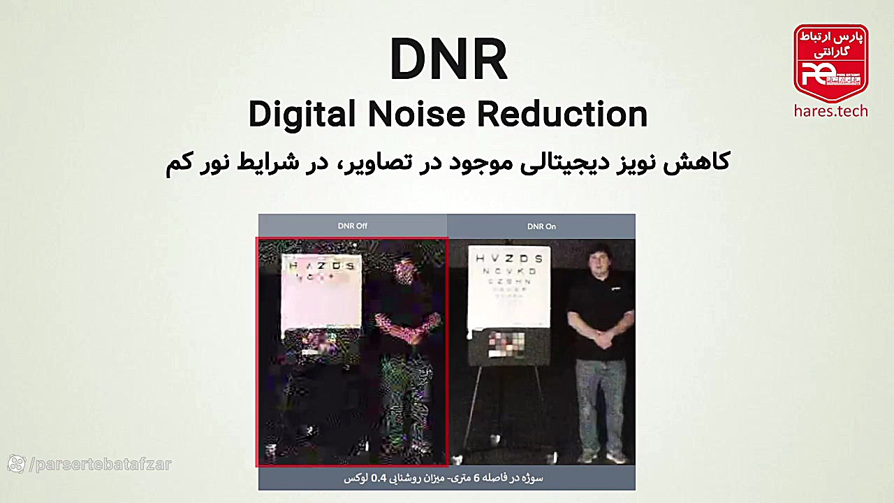 ویدئوی کاهش نویز دیجیتال (DNR) در دوربین های مدار بسته پوسیدگی دندان
