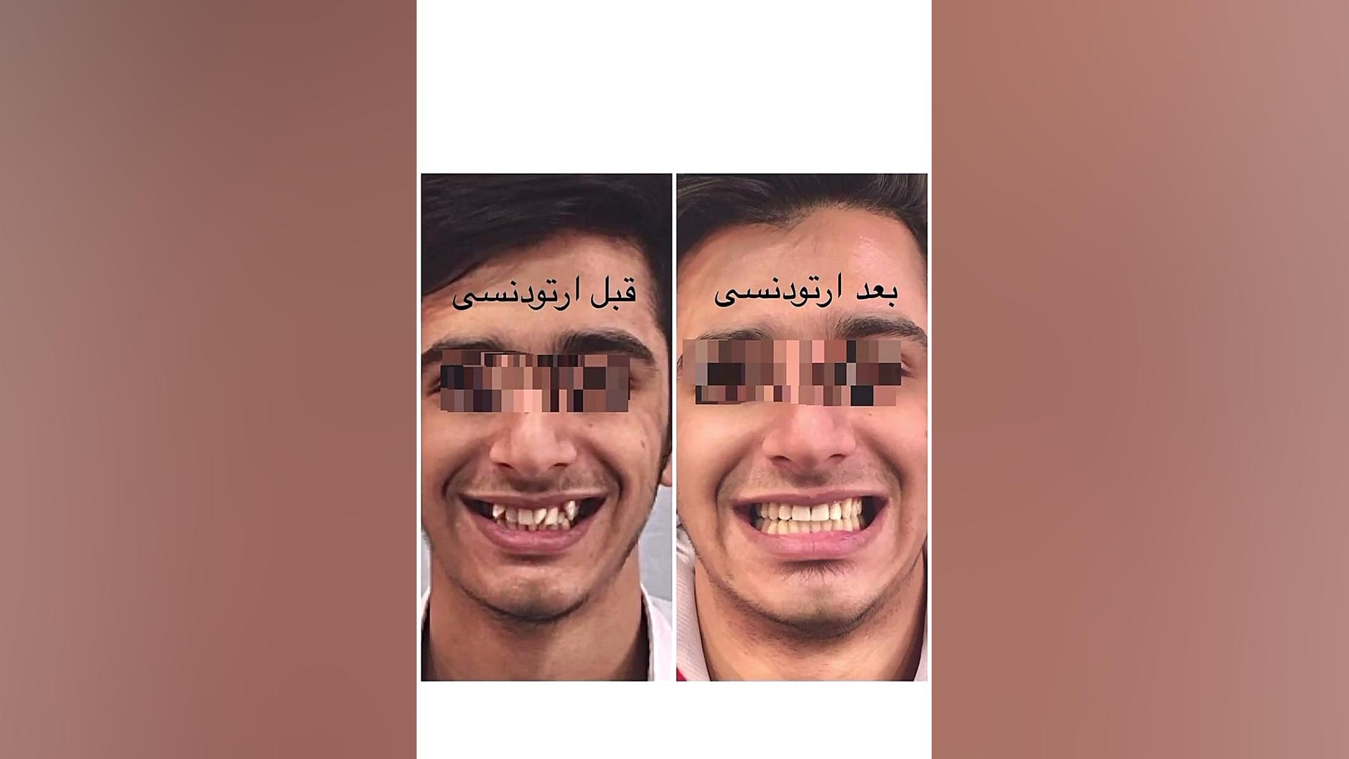 ارتودنسی دکتر فهیمی دكتر مهدي فهيمي هنزائي