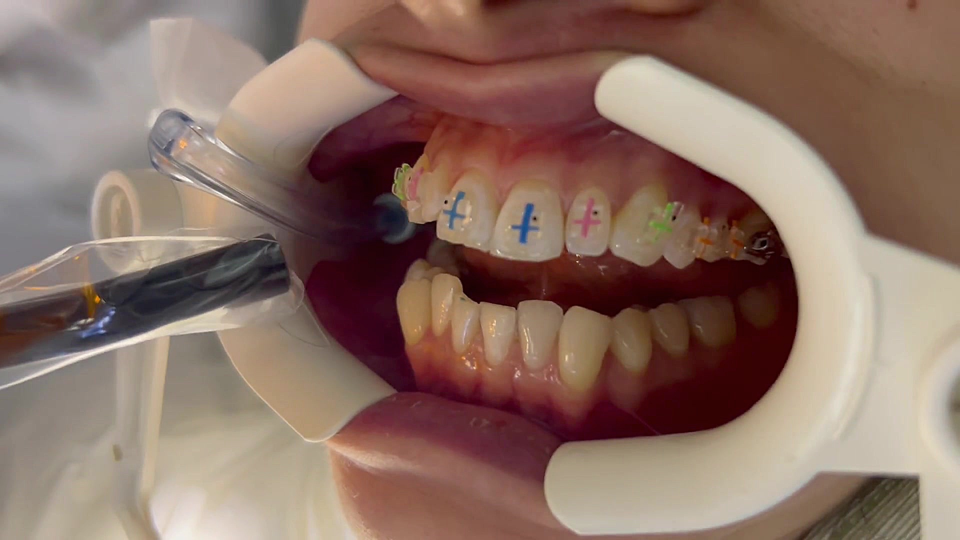 متخصص ارتودنسی دکتر فهیمی دكتر مهدي فهيمي هنزائي