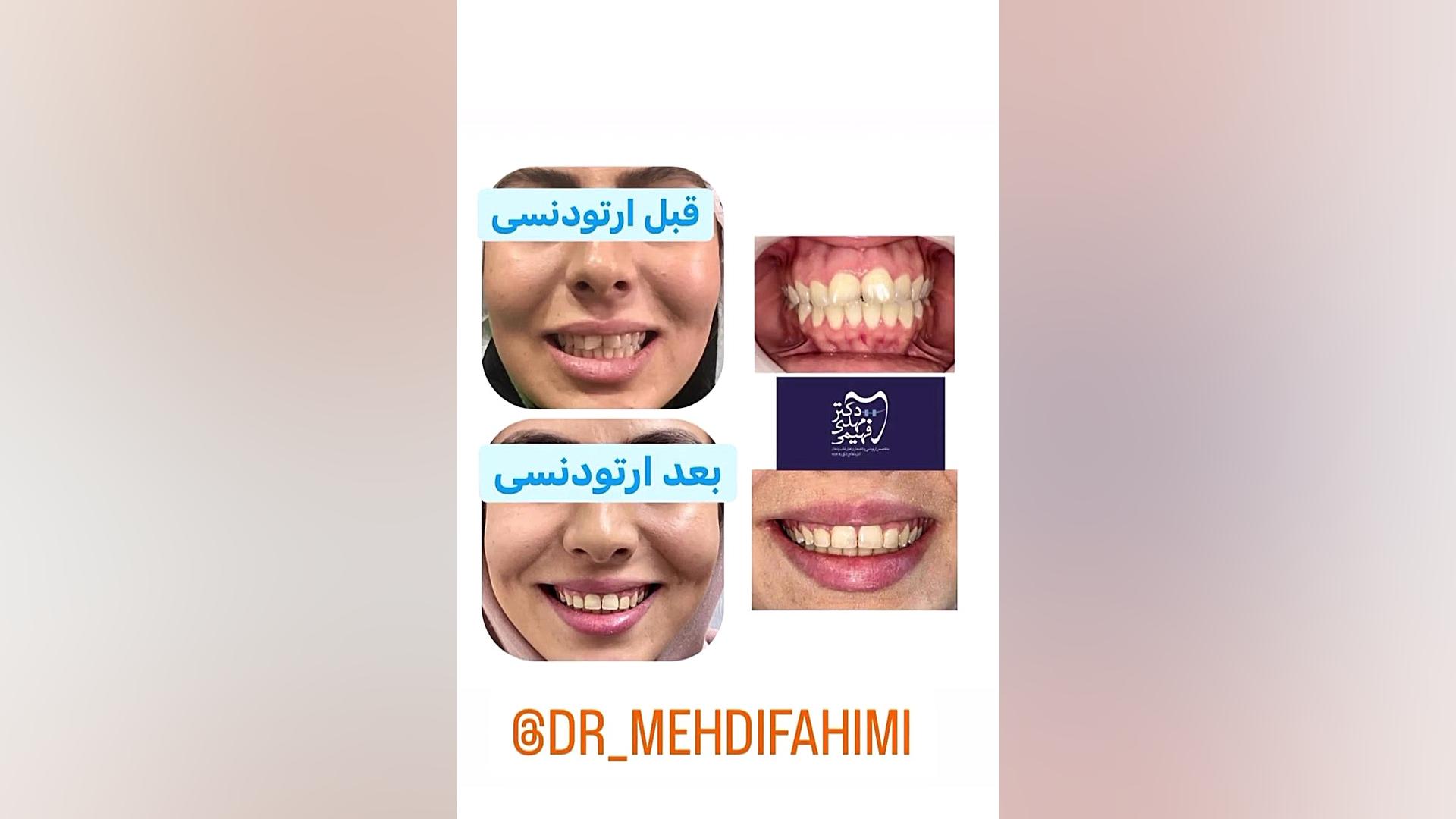 دکتر فهیمی متخصص ارتودنسی دكتر مهدي فهيمي هنزائي