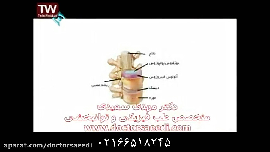 درمان دیسک کمر دکتر مهدی سعیدی
