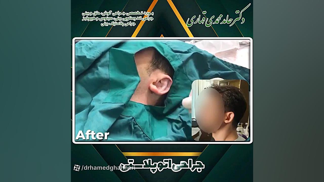 قیمت جراحی گوش برجسته دکتر حامد محمدی قهاری