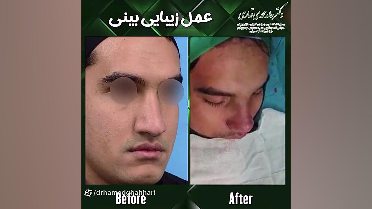 فيلم عمل بيني به روش بسته دکتر حامد محمدی قهاری