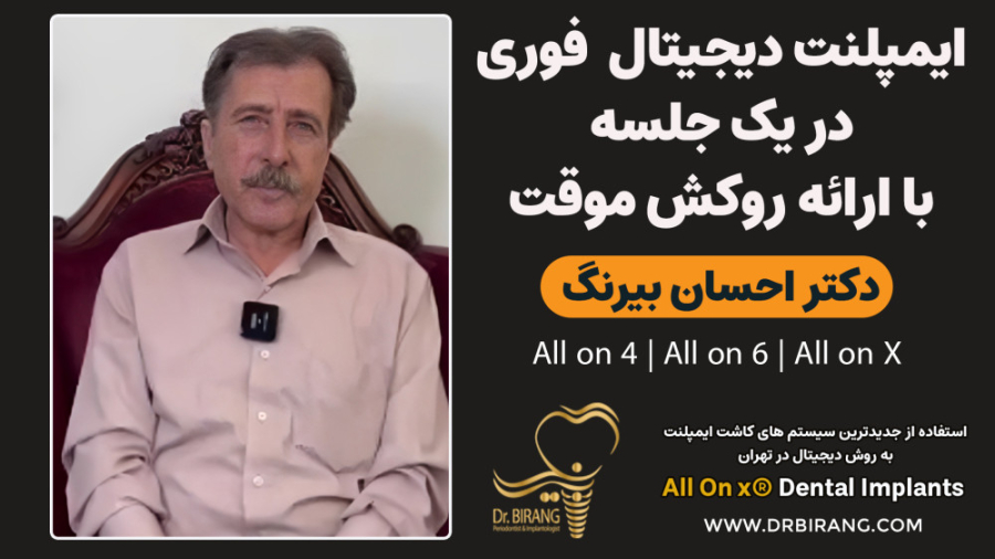 ایمپلنت دیجیتال فوری در یک جلسه با روکش موقت | دکتر احسان بیرنگ |تهران دکتر احسان بیرنگ