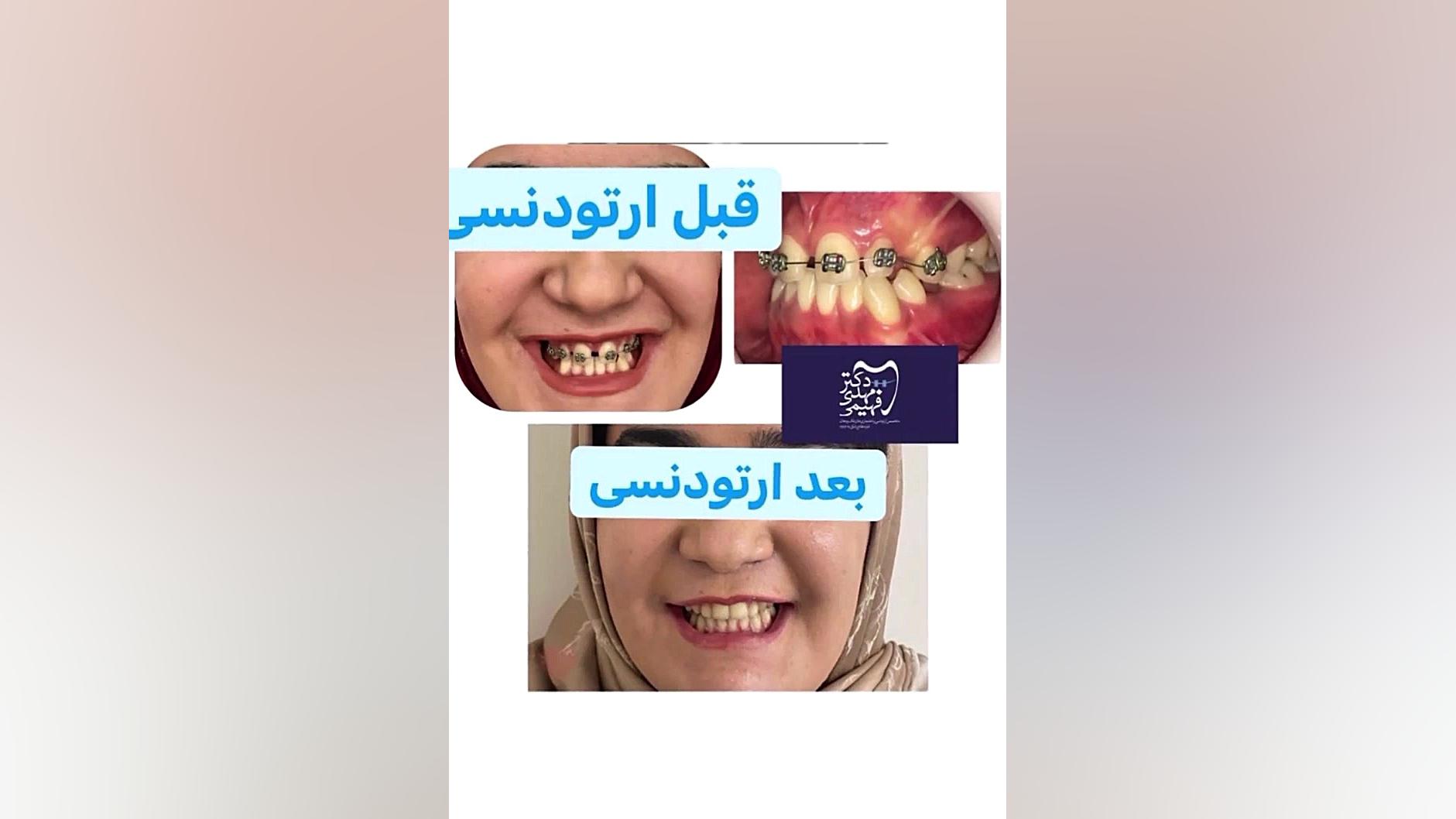 ارتودنسی دکتر فهیمی دكتر مهدي فهيمي هنزائي
